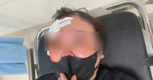 Read more about the article Bản tin chiều 7/5: Nữ tài xế Hà Nội tố bị người đi ô tô dùng dùi cui vụt vào đầu