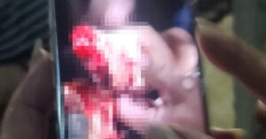 Read more about the article Bản tin trưa 7/5: Truy bắt nhóm thanh niên chém đứt lìa bàn tay người đàn ông