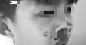 Read more about the article Hai học sinh trêu nhau, phụ huynh đánh nam sinh lớp 7 nhập viện