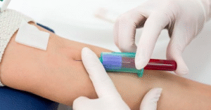 Read more about the article Người dân đổ xô xét nghiệm dấu ấn ung thư mong phát hiện sớm, chuyên gia nói gì?