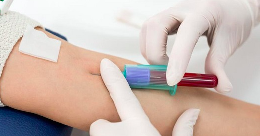 You are currently viewing Người dân đổ xô xét nghiệm dấu ấn ung thư mong phát hiện sớm, chuyên gia nói gì?