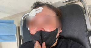 Read more about the article Nữ tài xế ở Hà Nội ‘tố’ bị người đi ô tô dùng dùi cui đánh vào đầu