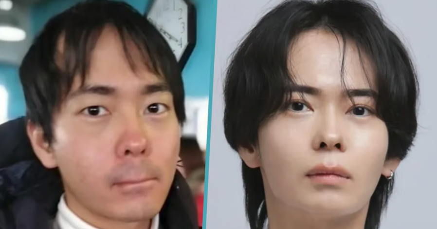 You are currently viewing Bị chê hói, người yêu bỏ, chàng trai lột xác ngoạn mục sau 10 năm