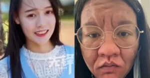 Read more about the article Cô gái gây sốc vì gương mặt thay đổi không nhận ra khi mang thai