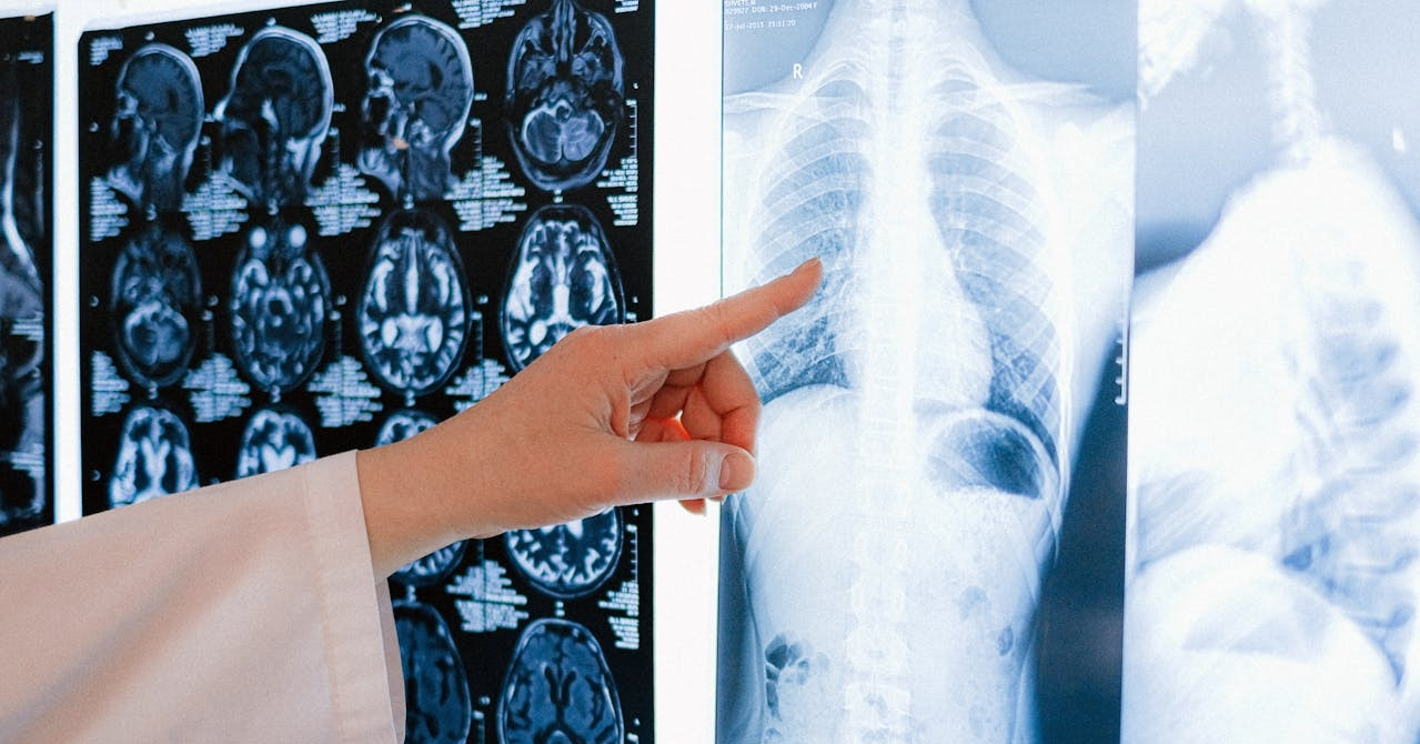 Read more about the article HLV thể hình ăn uống kỷ luật vẫn bị ung thư, bác sĩ chỉ ra thói quen nguy hại
