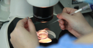 Read more about the article Mò tìm một vài tinh trùng còn sót lại giúp người đàn ông trẻ có con