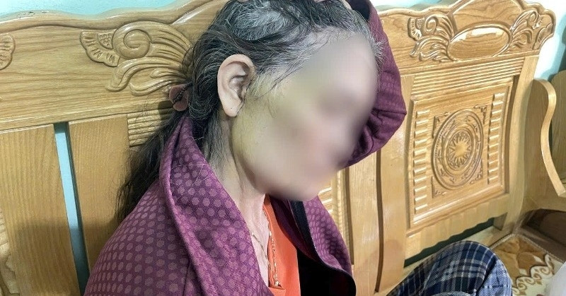 Read more about the article Người phụ nữ 64 tuổi đi thẩm mỹ căng da mặt gặp biến chứng nghiêm trọng
