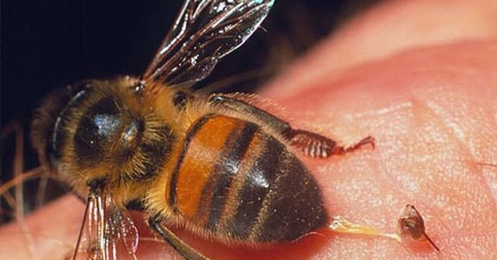 You are currently viewing Người phụ nữ trốn khỏi bệnh viện, mua ong đốt vào ngực chữa ung thư