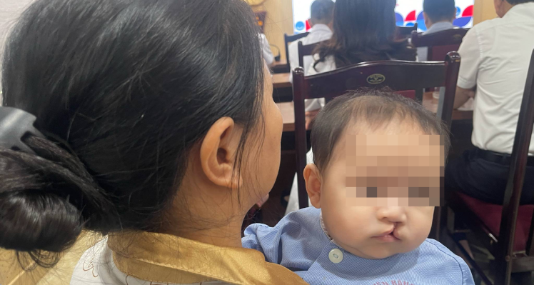 Read more about the article Sửa dị tật hở hàm ếch miễn phí cho trẻ