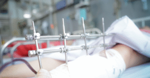 Read more about the article Tình trạng sức khỏe bệnh nhân vụ sập nhà làm 2 người chết