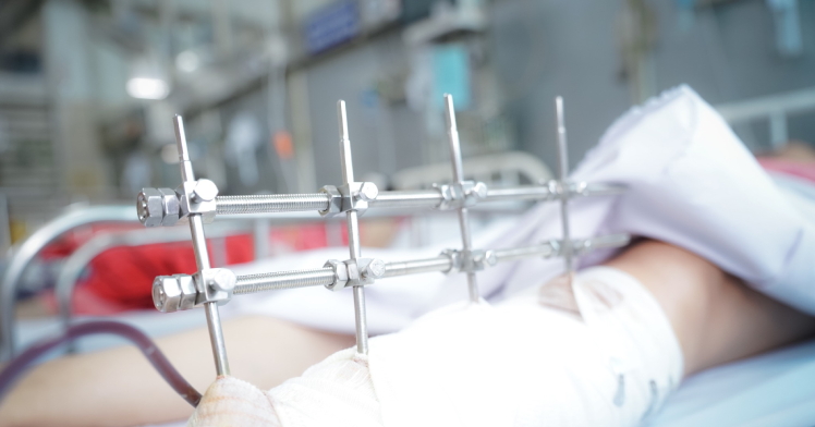 You are currently viewing Tình trạng sức khỏe bệnh nhân vụ sập nhà làm 2 người chết